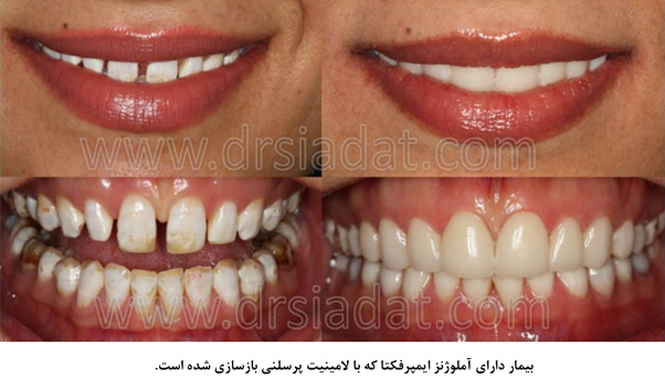 دکتر صیادت - دندانپزشکی زیبایی